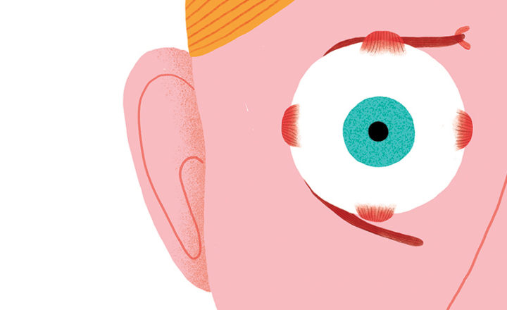 Illustration strabisme