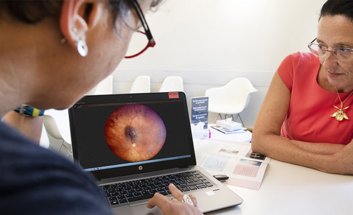 Tumeurs intraoculaires proton, sur ordinateur
