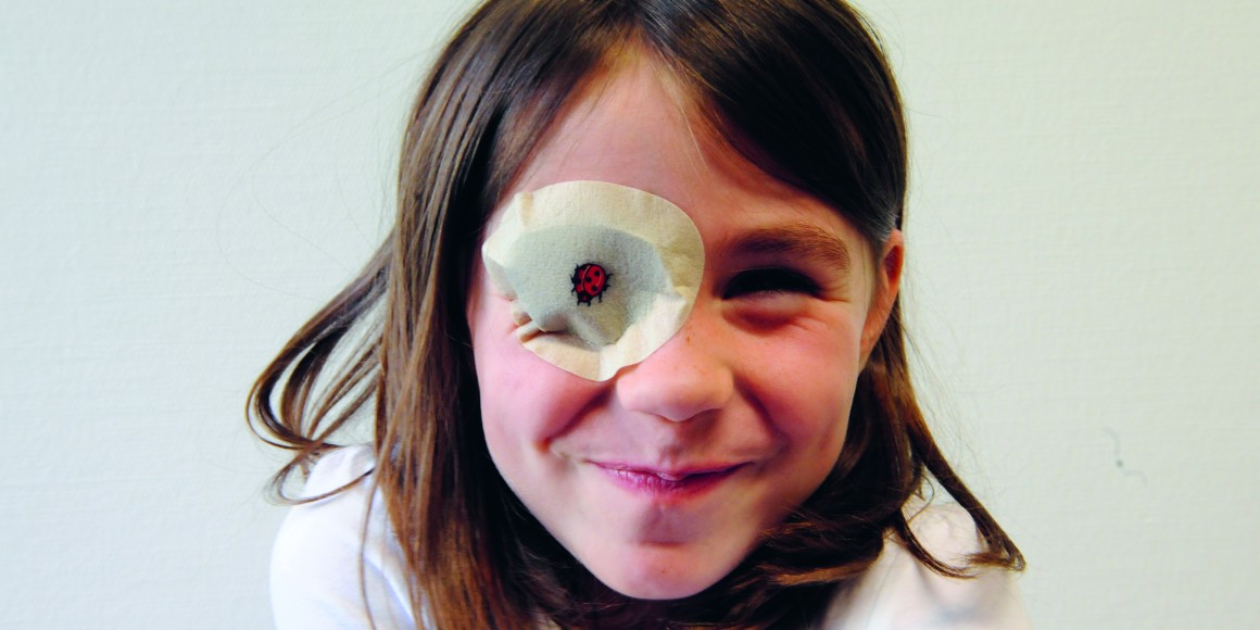 Image d'une petite fille avec une amblyopie