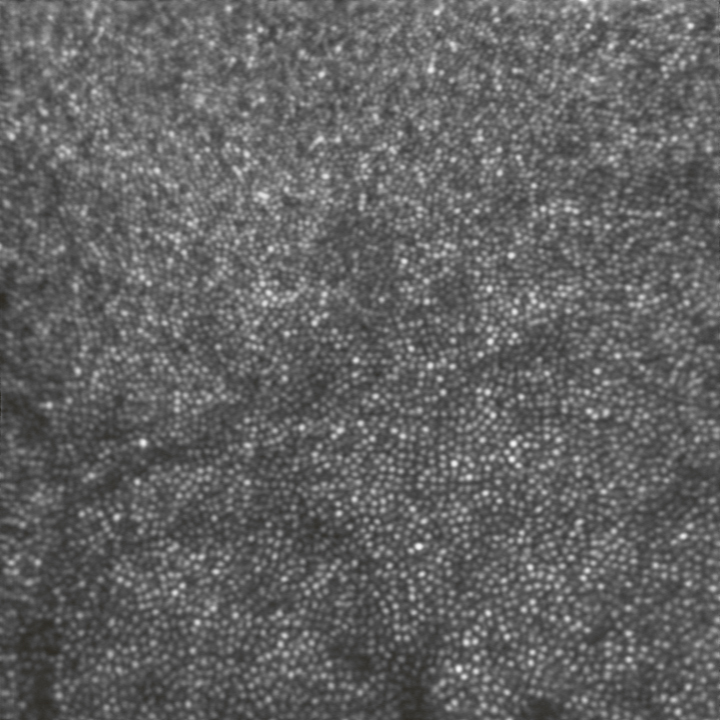 Image des cellules rétiniennes dans le cadre de l'étude sur le décollement de rétine, Airdrop. 