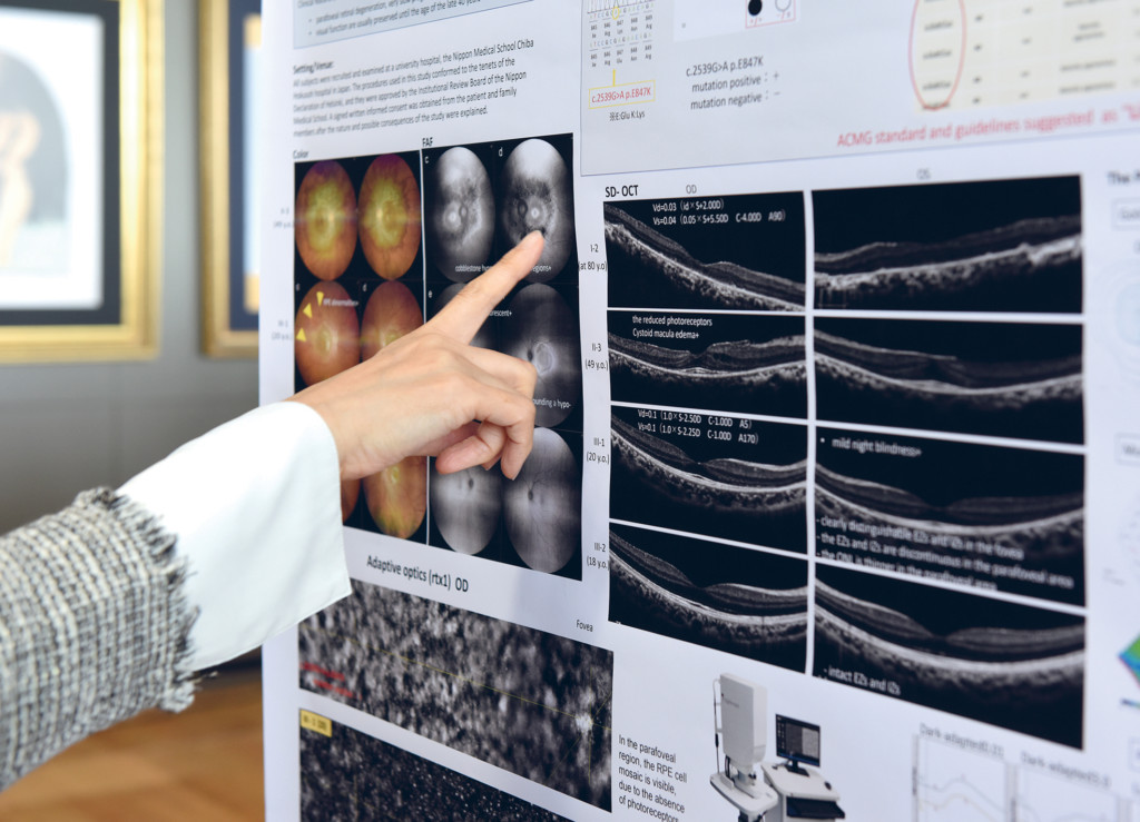 D’abord développée pour l’astronomie, l’optique adaptative permet aujourd’hui d’observer très précisément la rétine in vivo.