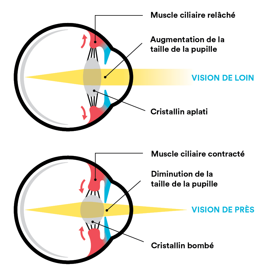 Schéma illustrant le cristallin et l'oeil avec une vision de loin et une vision de près
