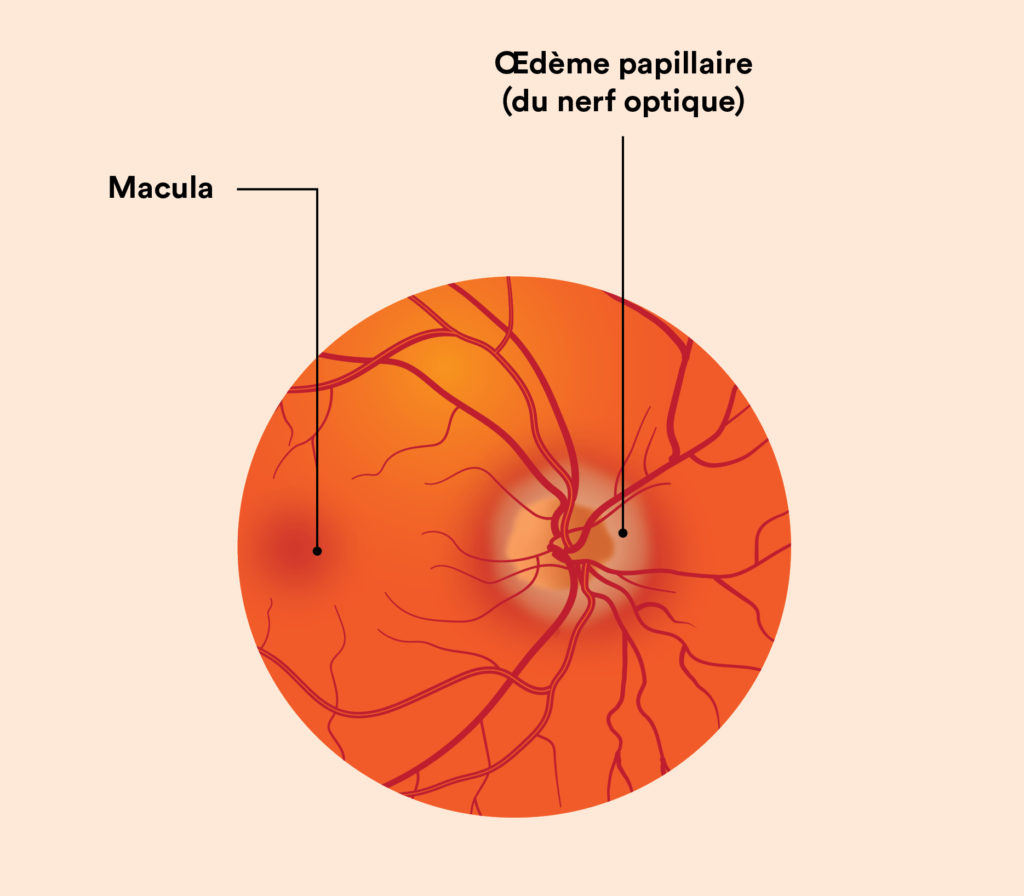 Schéma de l'oeil 