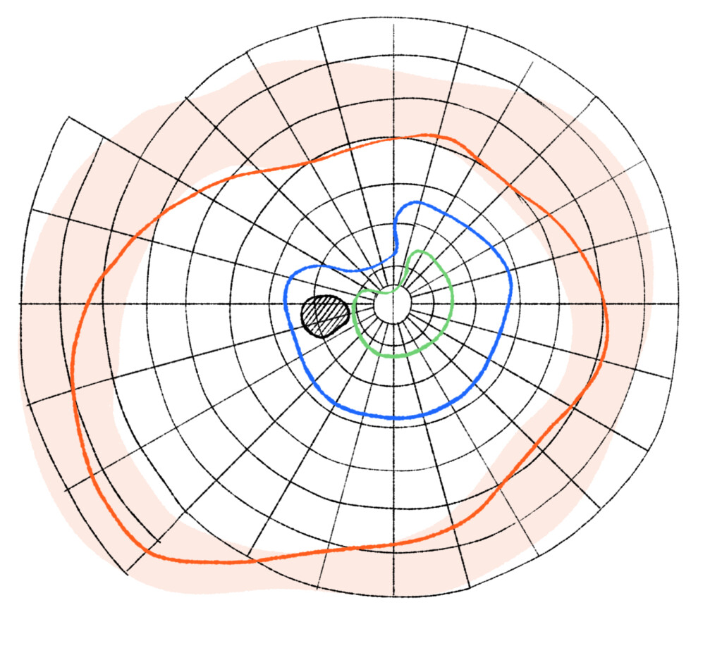 Image d'un examen du champ visuel